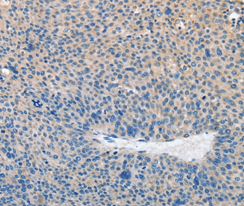 PRKG2 Antibody