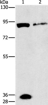 PRKG2 Antibody