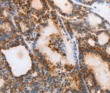 MUC6 Antibody