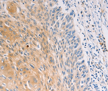 MUC5B Antibody