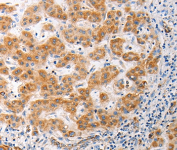 MUC13 Antibody