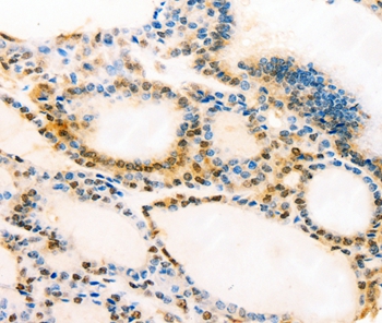 MUC16 Antibody