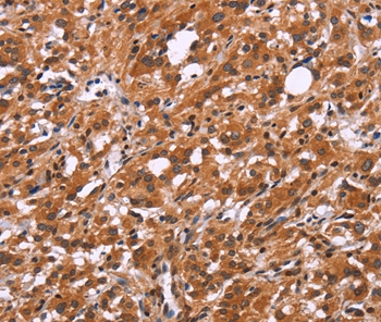 SLC8A2 Antibody