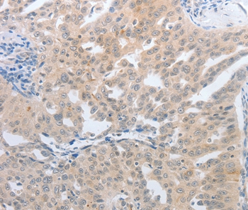 NFAT5 Antibody