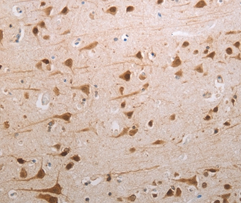 MDC1 Antibody