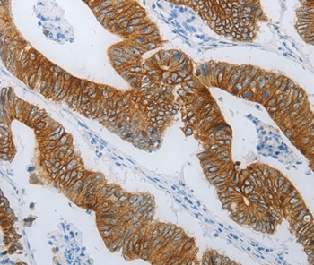 TMEM8B Antibody