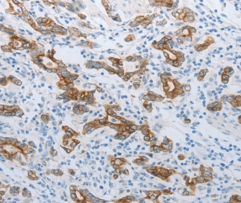 TMEM8B Antibody