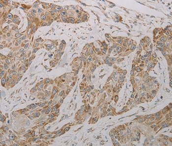 TAC1 Antibody