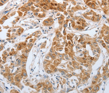 RTN4 Antibody