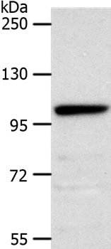 NOTCH2 Antibody