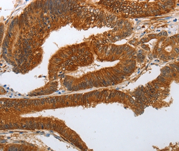 NOTCH3 Antibody