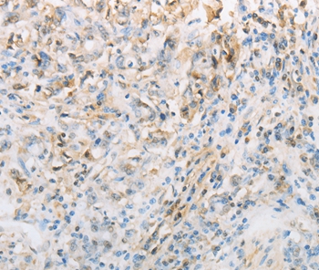 NPPC Antibody