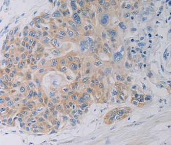 CLEC4C Antibody