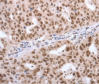 POU3F1 Antibody