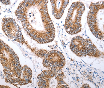 HCRTR1 Antibody