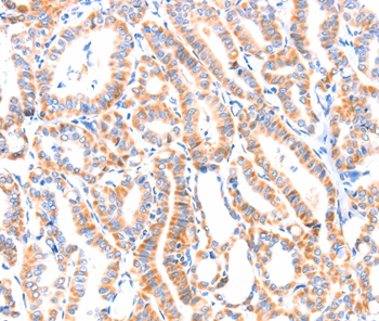 PAFAH2 Antibody