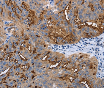 PODXL Antibody