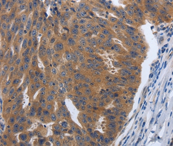 PDGFA Antibody