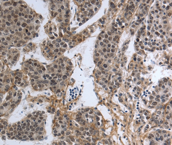 PMS2 Antibody