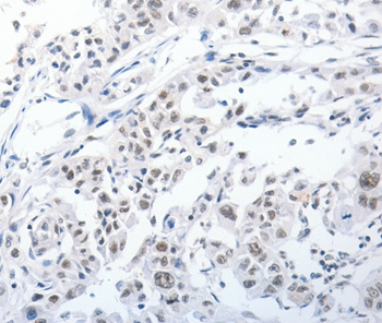 PKD2 Antibody