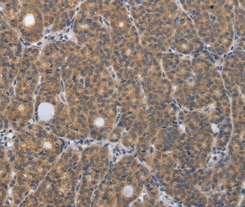 PGR Antibody
