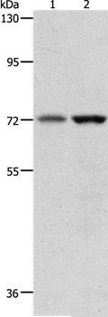 PGR Antibody