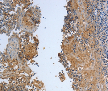 DLG4 Antibody