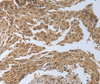 PSMD6 Antibody