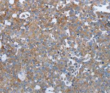 PTPRJ Antibody