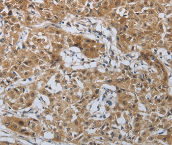 PTPRM Antibody