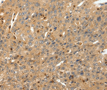 RRAD Antibody