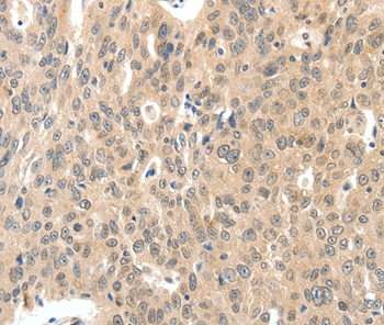 ROS1 Antibody
