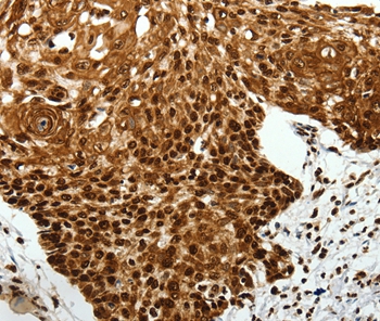 SCN1A/2A/3A/4A/5A/8A/9A/10A/11A/12A Antibody