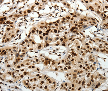 SCN1A/2A/3A/4A/5A/8A/9A/10A/11A/12A Antibody
