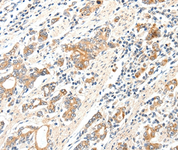 SCN2A Antibody