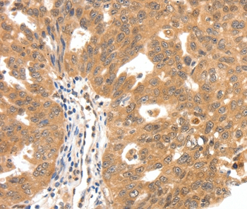 SCN5A Antibody