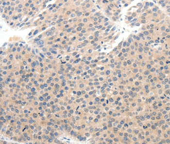 SCN10A Antibody