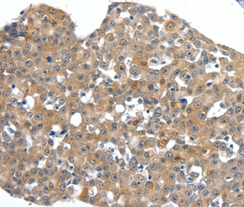 SCN11A Antibody