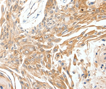 SCN11A Antibody