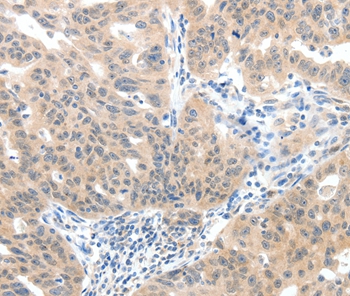 SLC20A1 Antibody