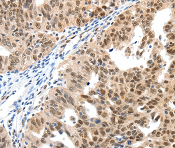 SP1 Antibody