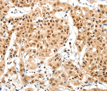 SIPA1 Antibody