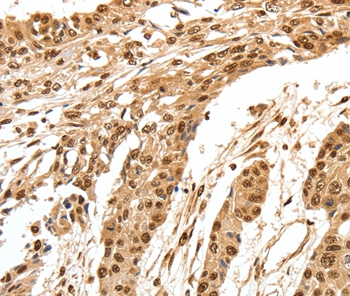 SPATA20 Antibody