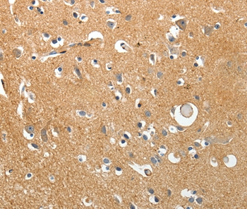 AKAP12 Antibody