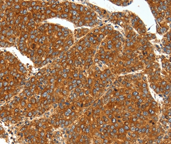SSTR1 Antibody