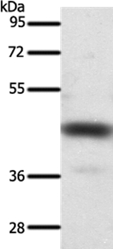 SSTR2 Antibody