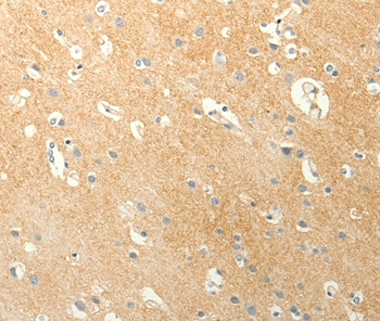 LPAR3 Antibody