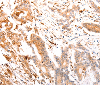 ABCA4 Antibody