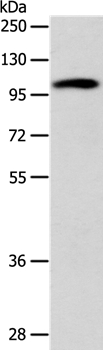 ADCY1 Antibody