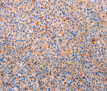 PLIN2 Antibody
